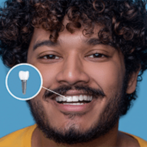 Implante Dentário_renato